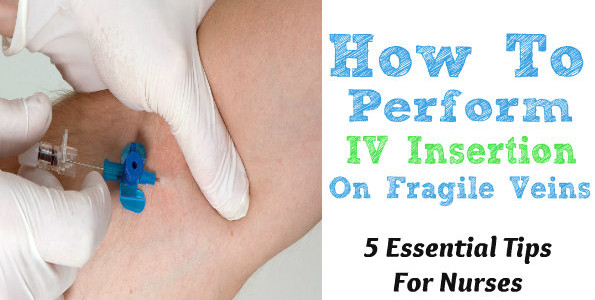 HOW TO PERFORM IV INSERTION ON VERY FRAGILE VEINS 5