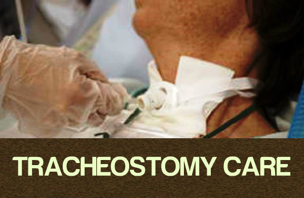 tracheostomy care