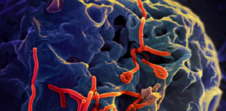 what nurses need to know about Ebola virus