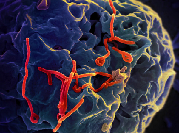 what nurses need to know about Ebola virus