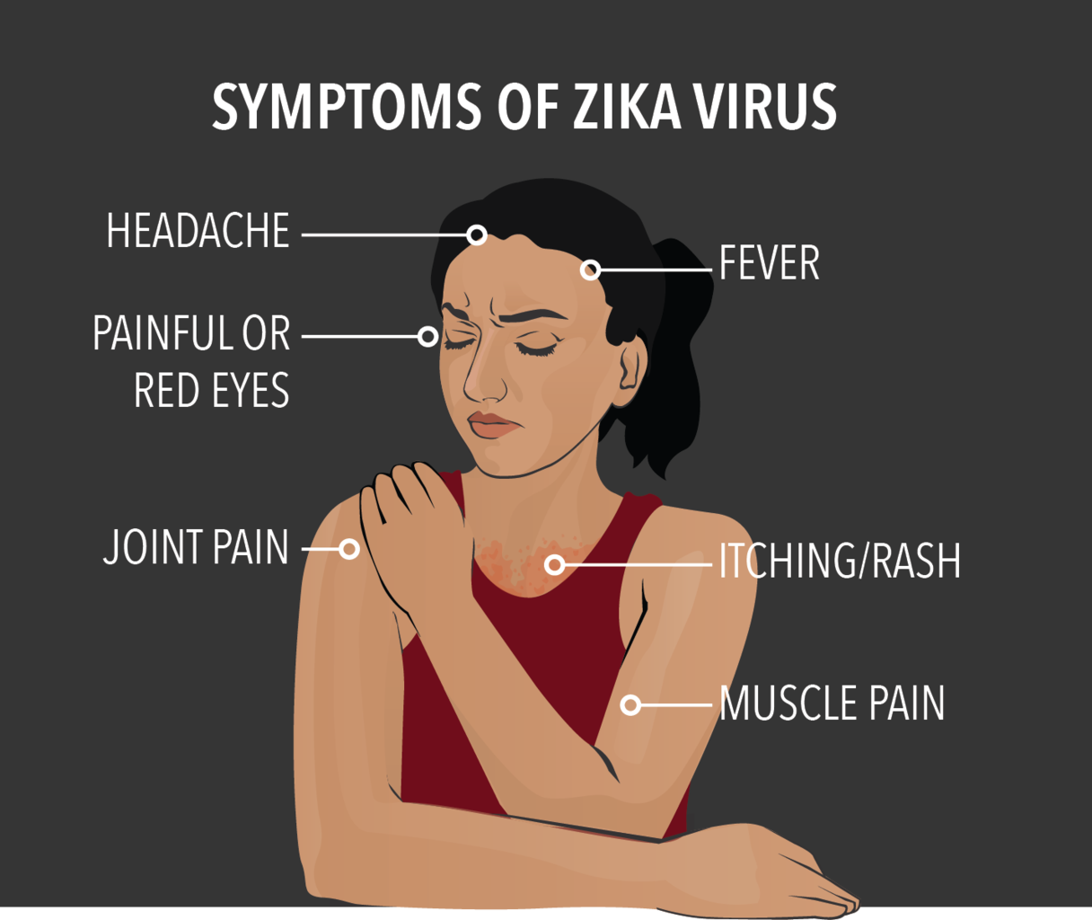 zika virus symptoms